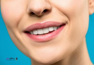 خرید شاین لب ویکتوریا